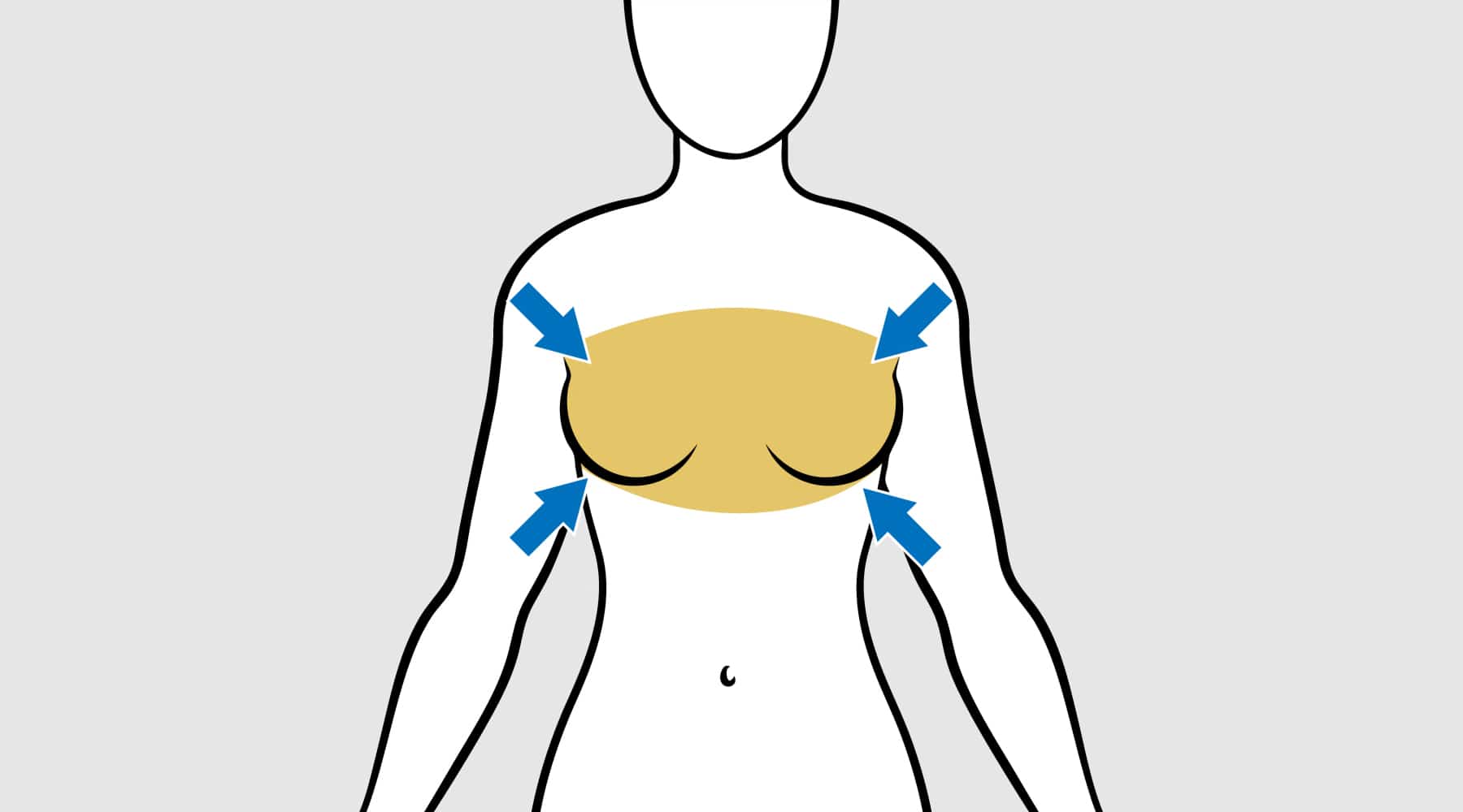 Breast Reduction Phoenix