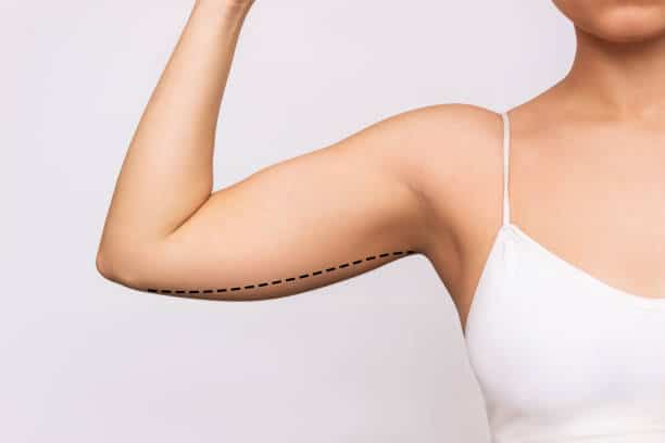 Cropped shot of a young woman with excess fat on her upper arm with marks for liposuction or plastic surgery isolated on a gray background. The loose and saggy muscles. Overweight. Beauty concept