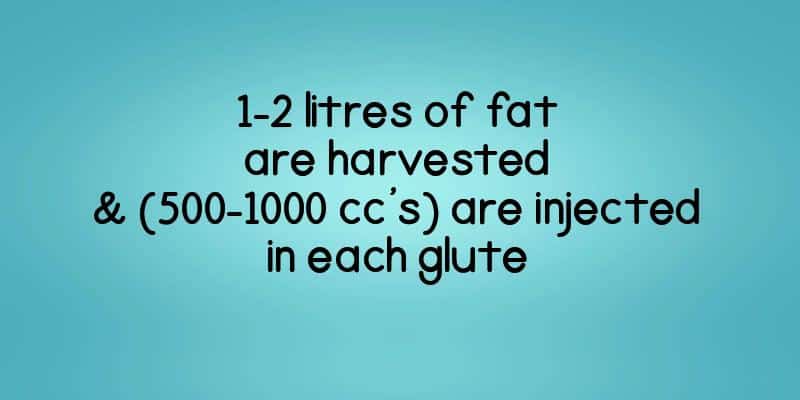 1-2 litres of fat are harvested & (500-1000 cc’s) are injected in each glute