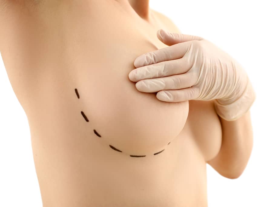 The era of the jumbo breast implant is over